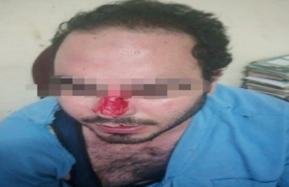 الاعتداء علي طبيب الطوارئ بمستشفي طنطا الجامعي